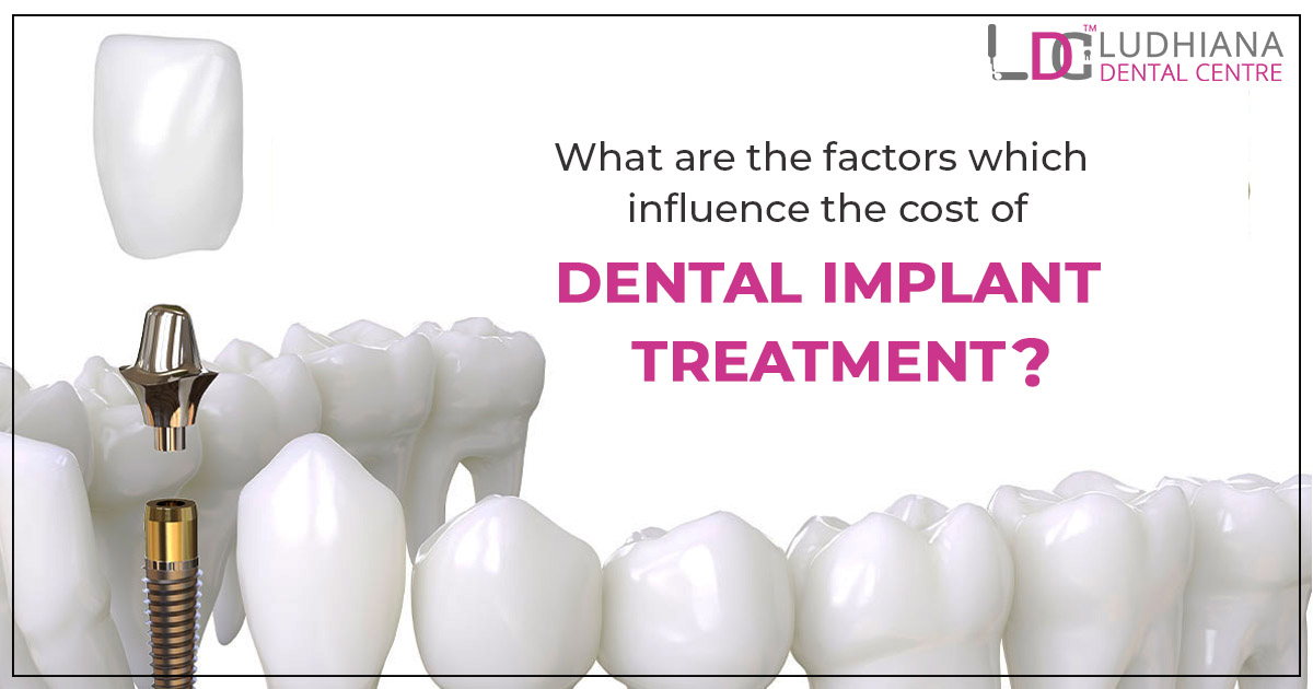 What are the factors which influence the cost of dental implant treatment