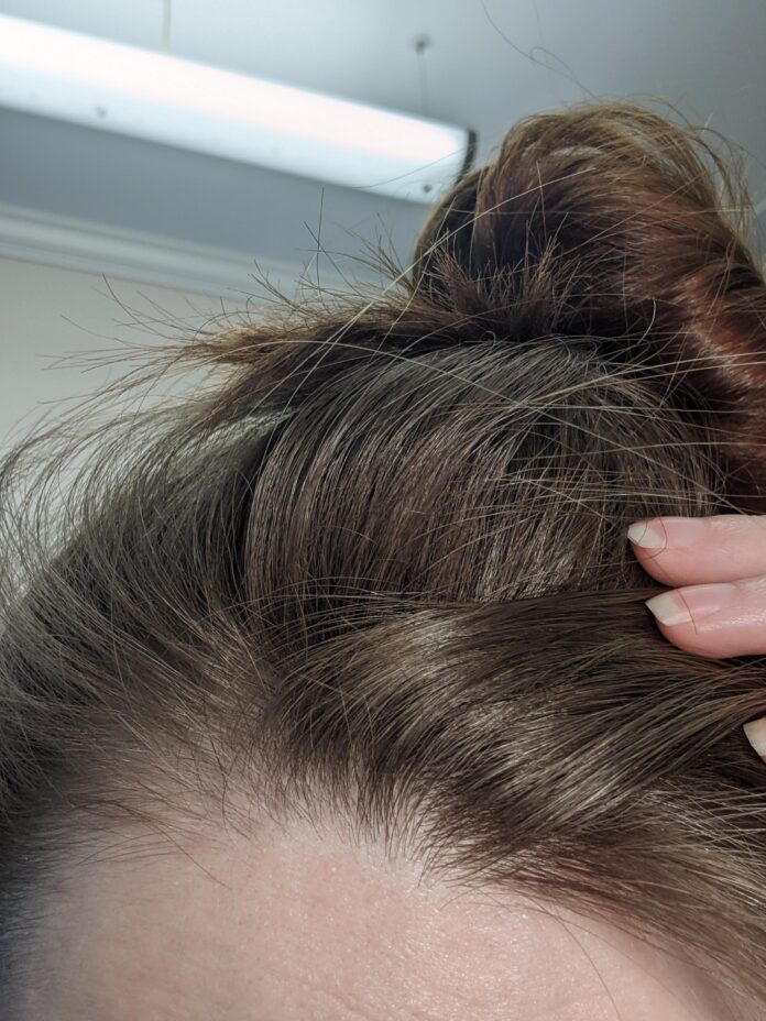 Hair